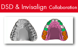 dsdinvisalign-on