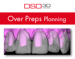 over_preps_planning